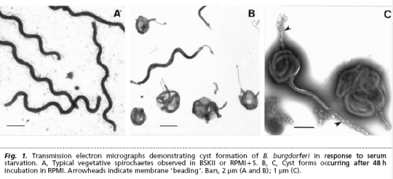 Borrelia-cysts1